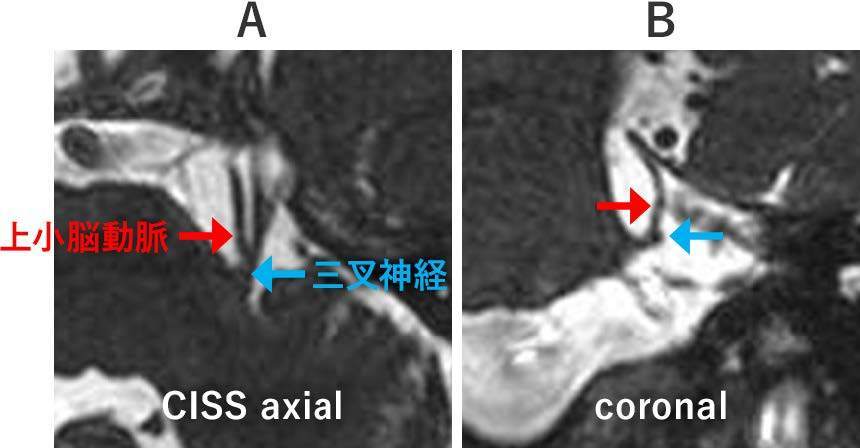 Figure1の画像