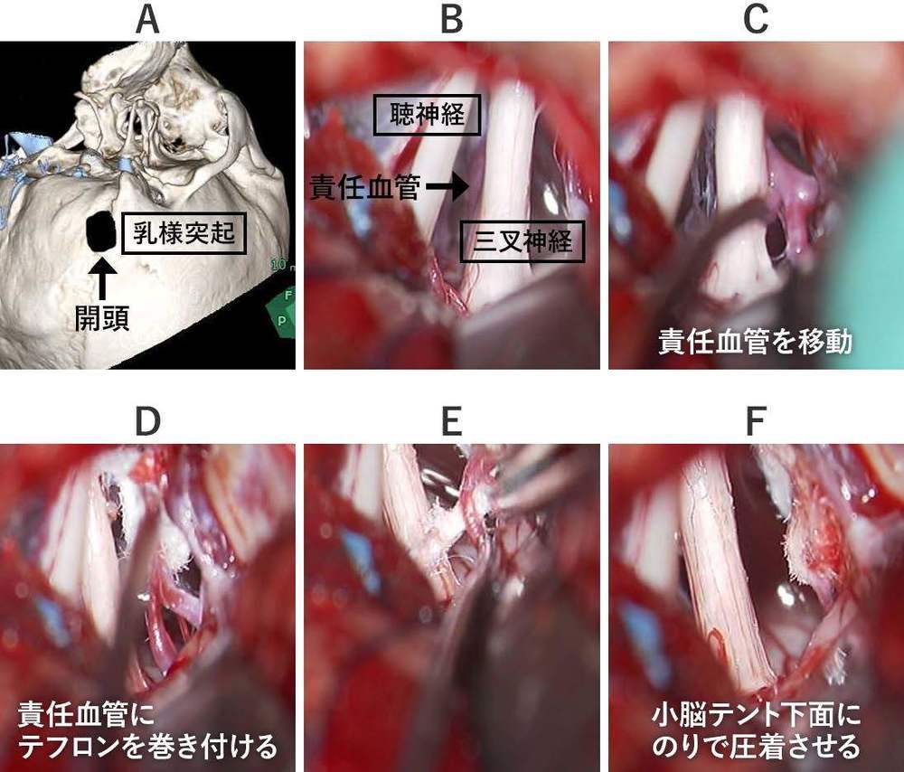 Figure2の画像