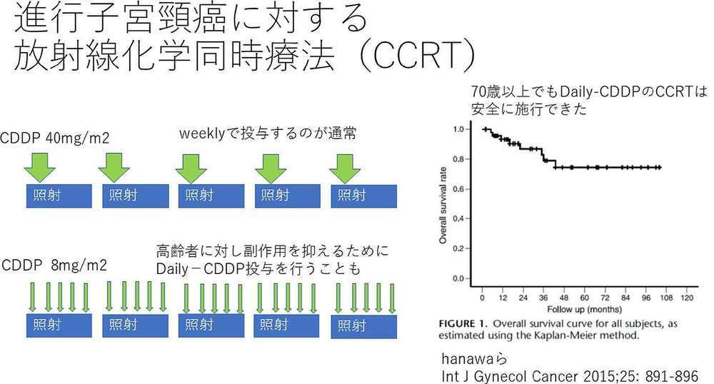 進行子宮頸がんに対する放射線化学同時療法