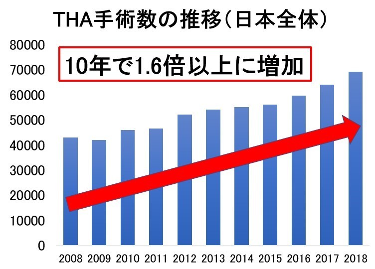 THA手術数の推移グラフ